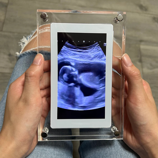 Relive® Motion Video Frame
