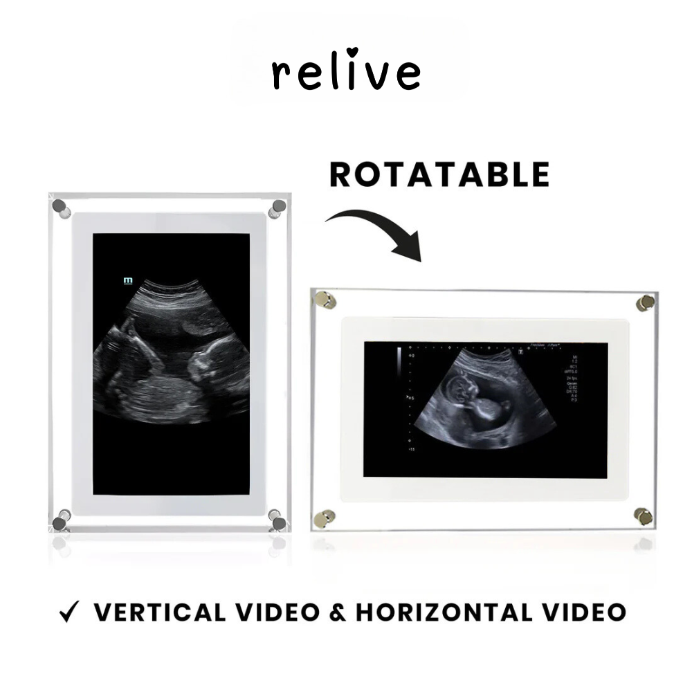 Relive® Motion Video Frame
