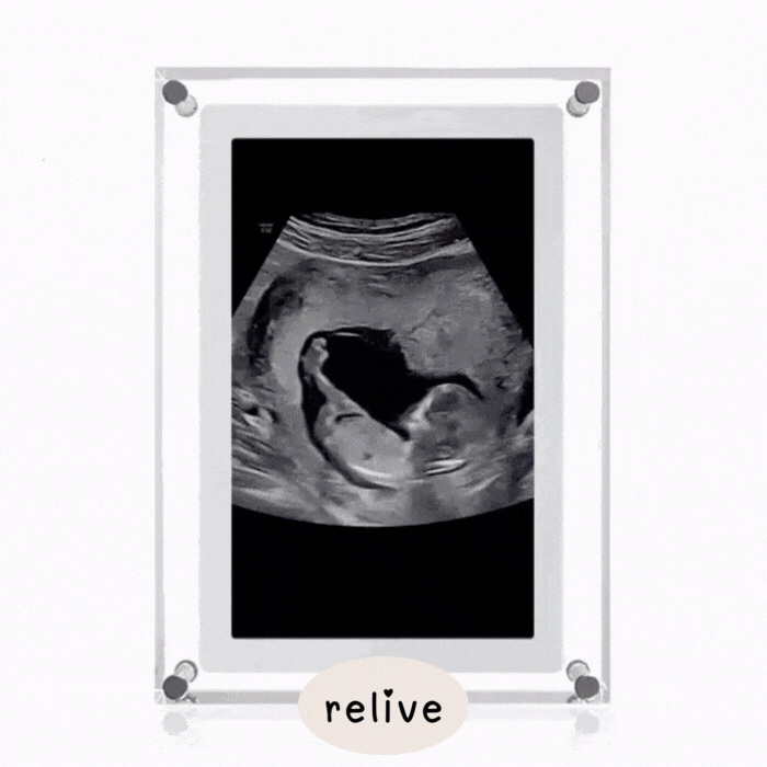 Relive® Motion Video Frame
