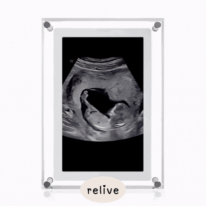 Relive® Motion Video Frame